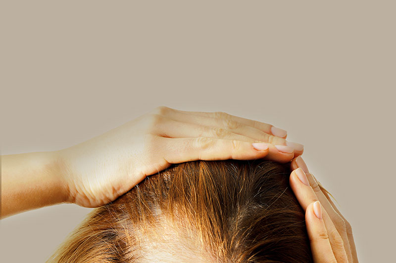 Hair Loss