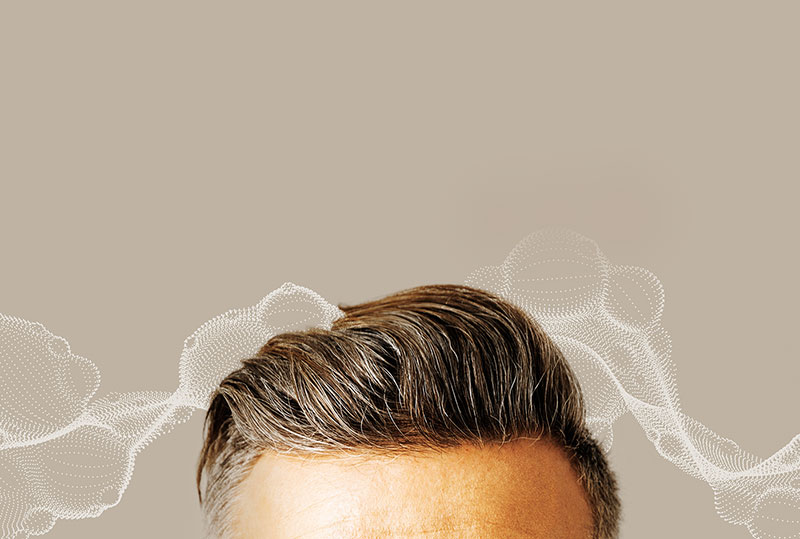 Hair Loss Causes